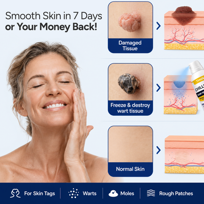 ChillErase® Bump Renewal Spray