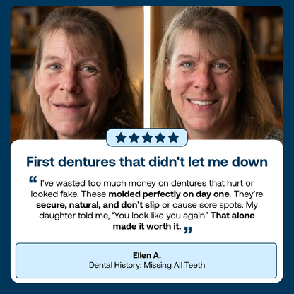 Lab Quality Self-Fitting Full Custom Dentures