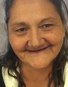 Before image for Linda Bennett