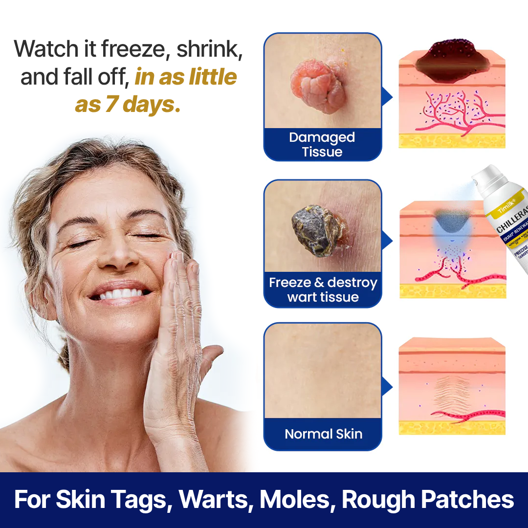 Timilk ChillErase® Bump Renewal Spray (Copy)